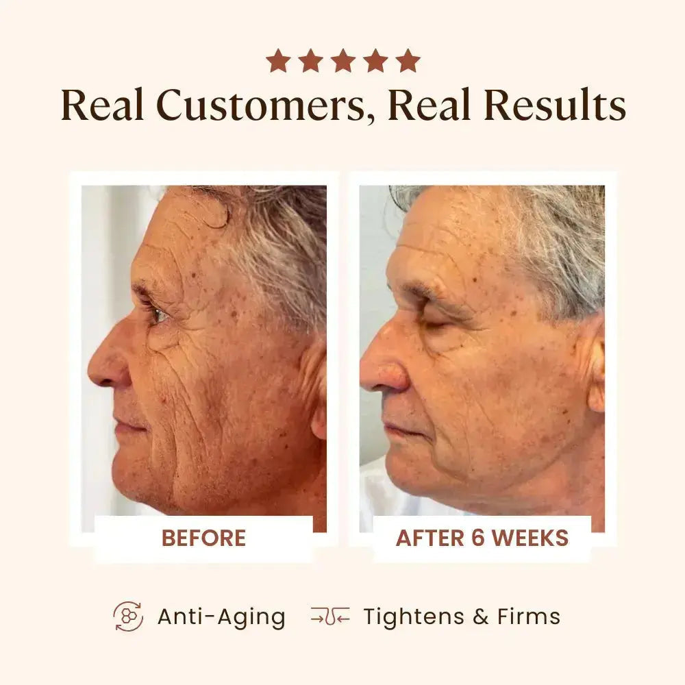 Plasma Skin Perfector - Sale