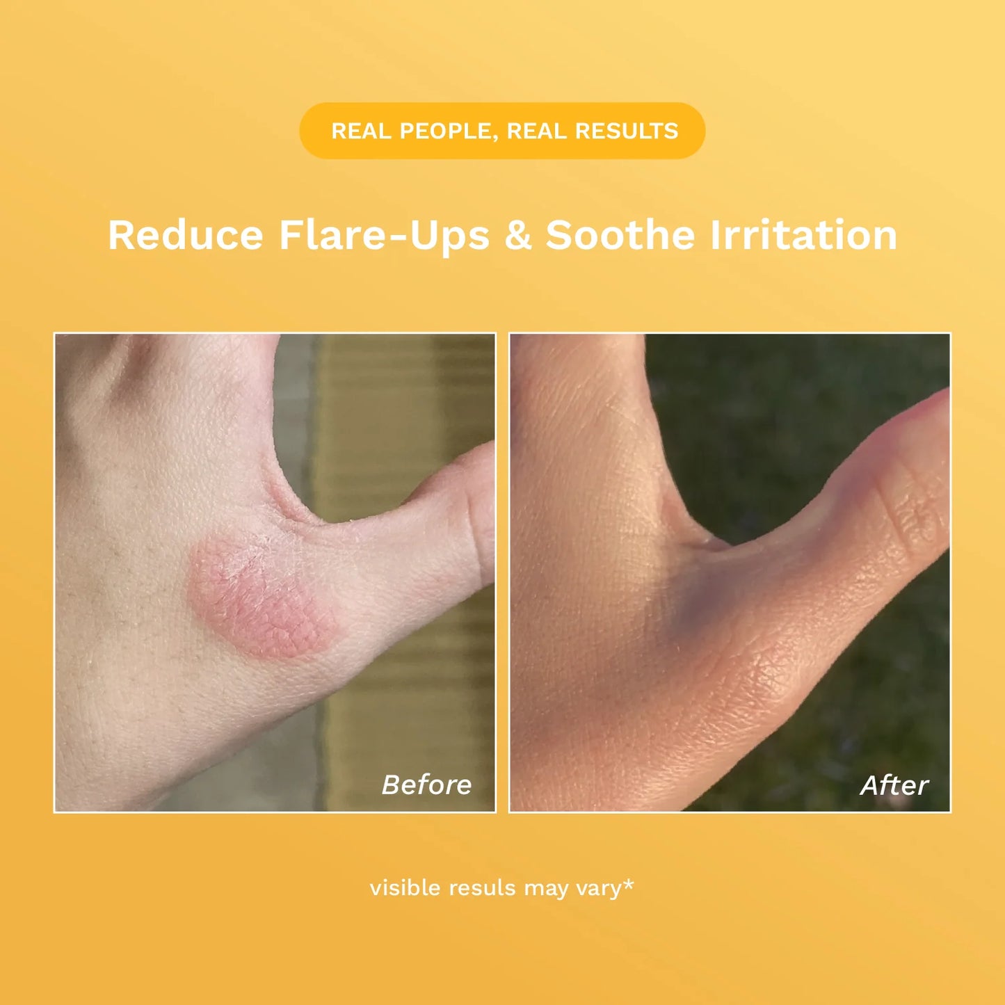 Rejûvaskin Skin Recovery Cream