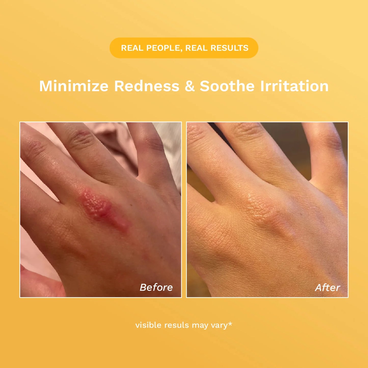 Rejûvaskin Skin Recovery Cream